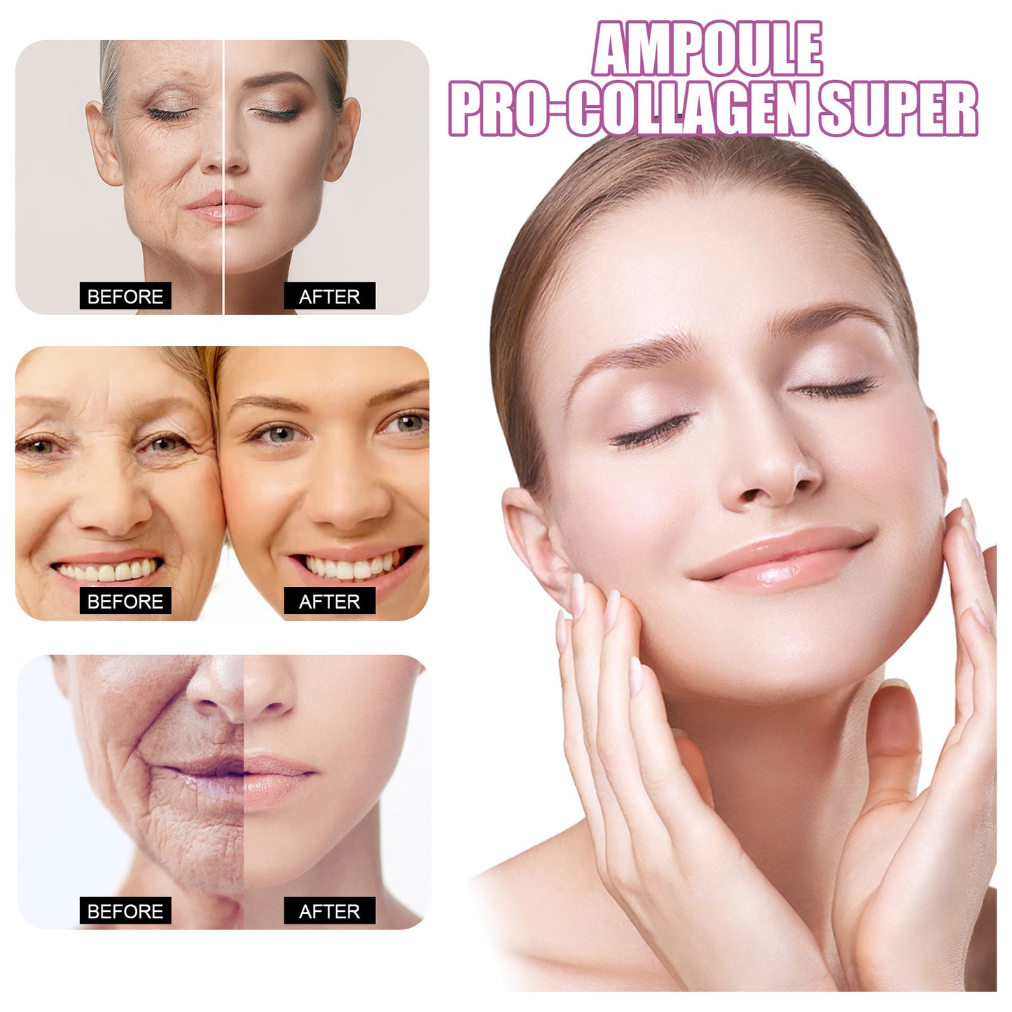 Ampolas Lifting Facial – EELHOE (Colágeno & Ceramidas)