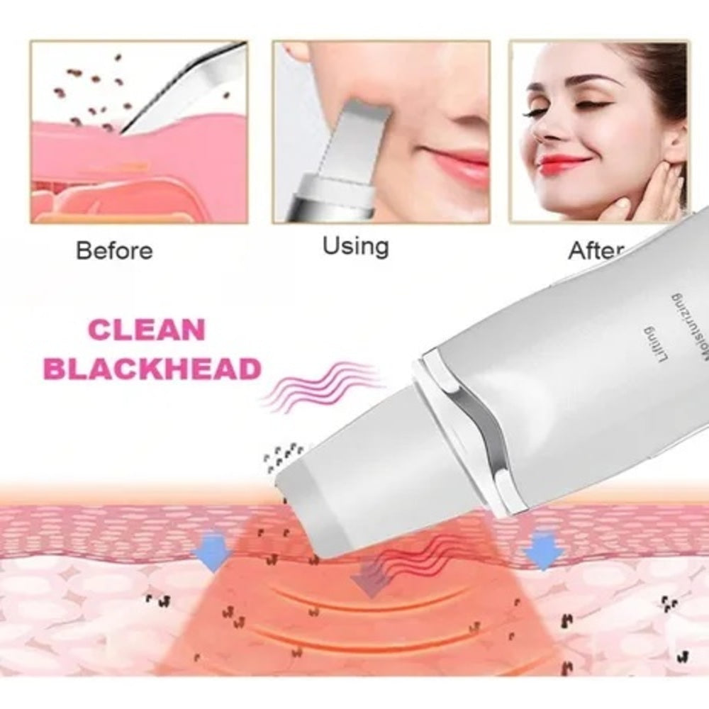 Peeling Ultrassônico Facial – Limpeza Profunda e Lifting