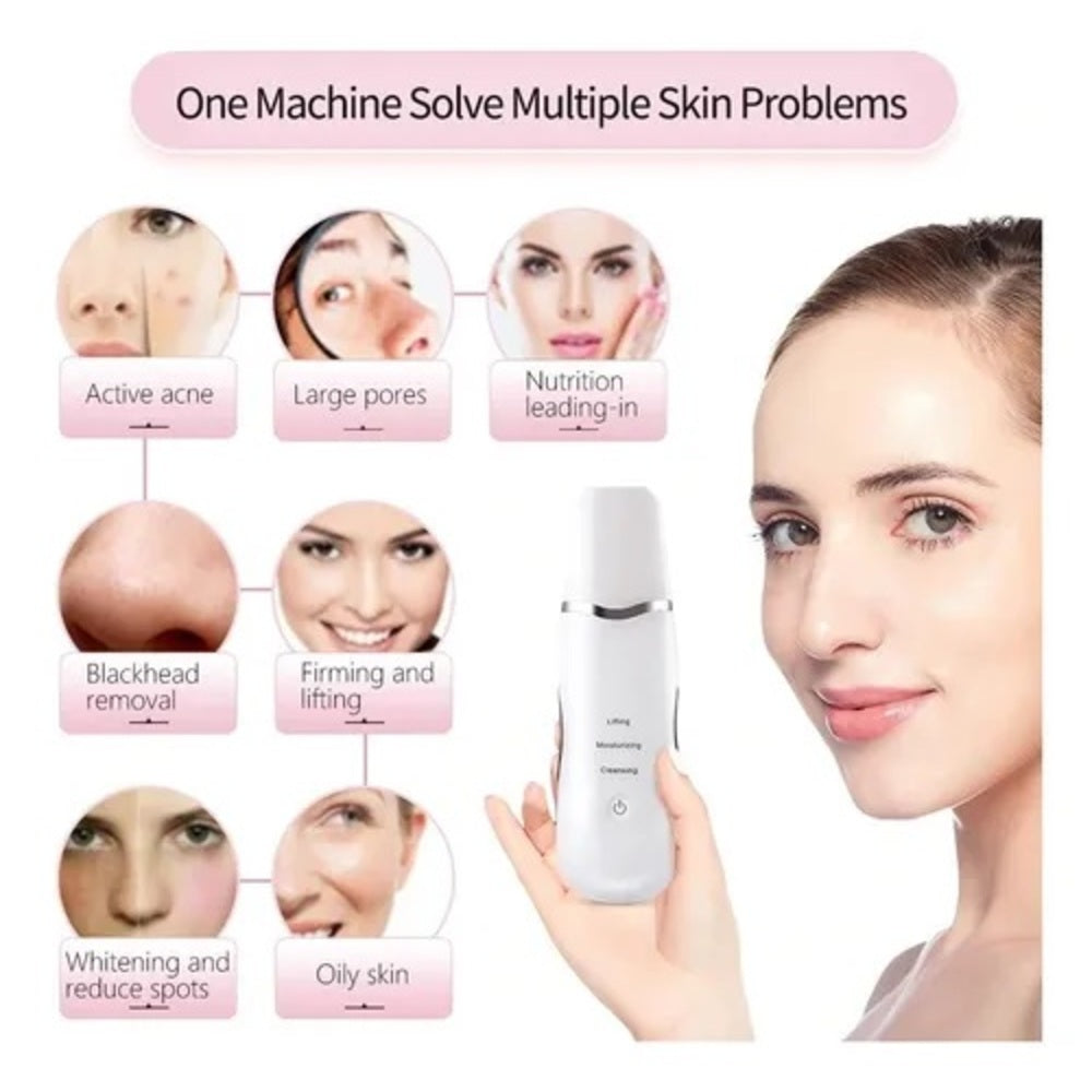 Peeling Ultrassônico Facial – Limpeza Profunda e Lifting