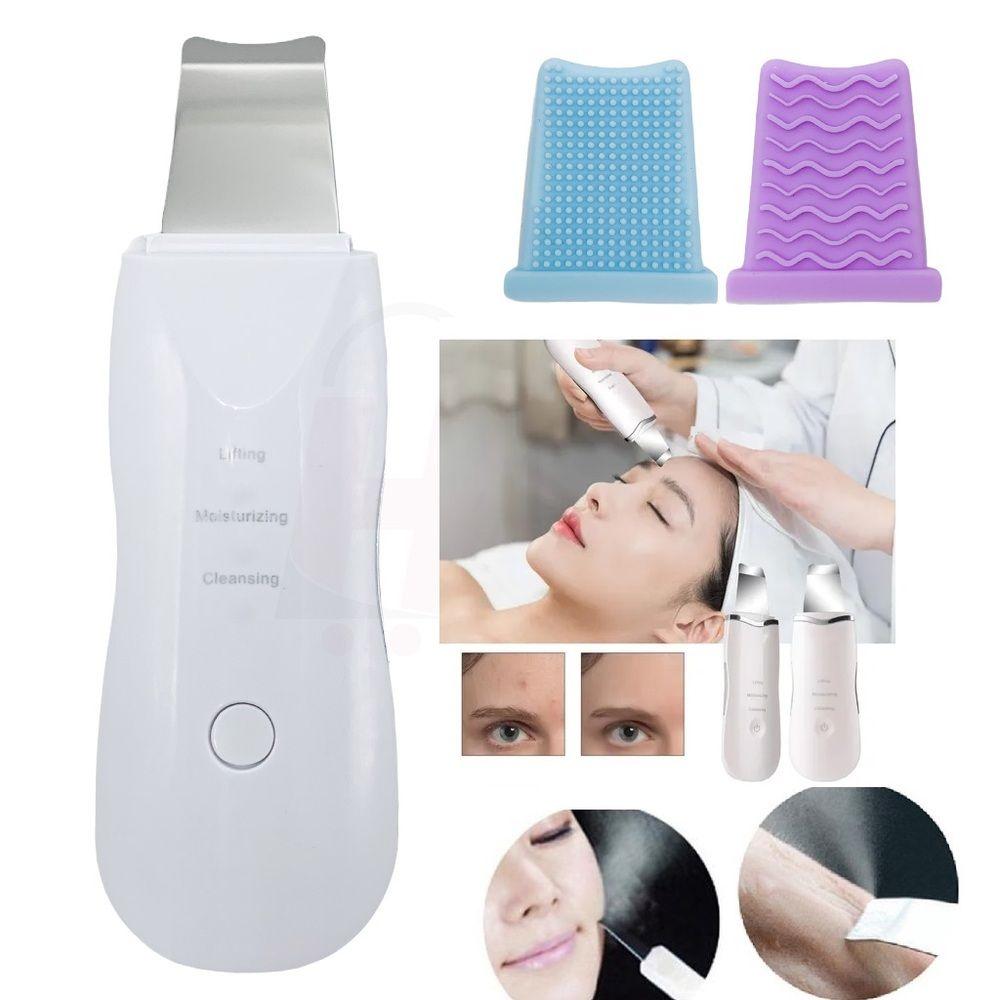 Peeling Ultrassônico Facial – Limpeza Profunda e Lifting