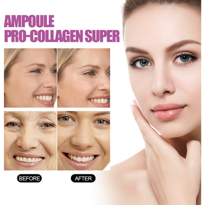 Ampolas Lifting Facial – EELHOE (Colágeno & Ceramidas)