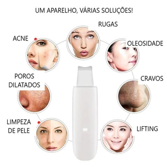 Peeling Ultrassônico Facial – Limpeza Profunda e Lifting