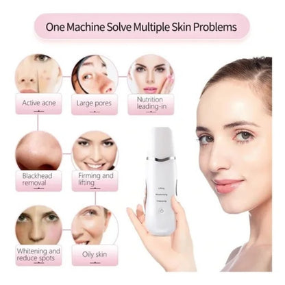 Peeling Ultrassônico Facial – Limpeza Profunda e Lifting